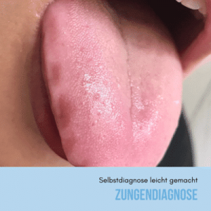 zungendiagnose