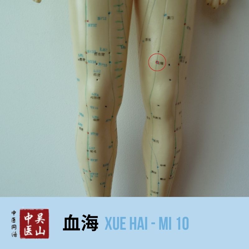 Xue Hai - Milz 10